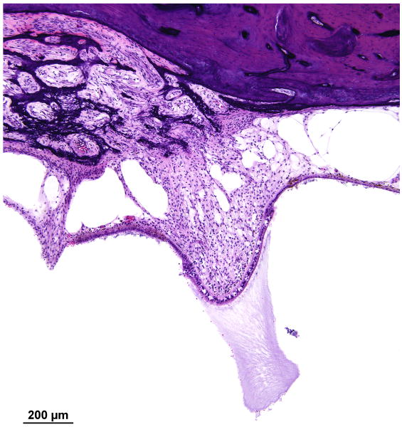 FIG. 12