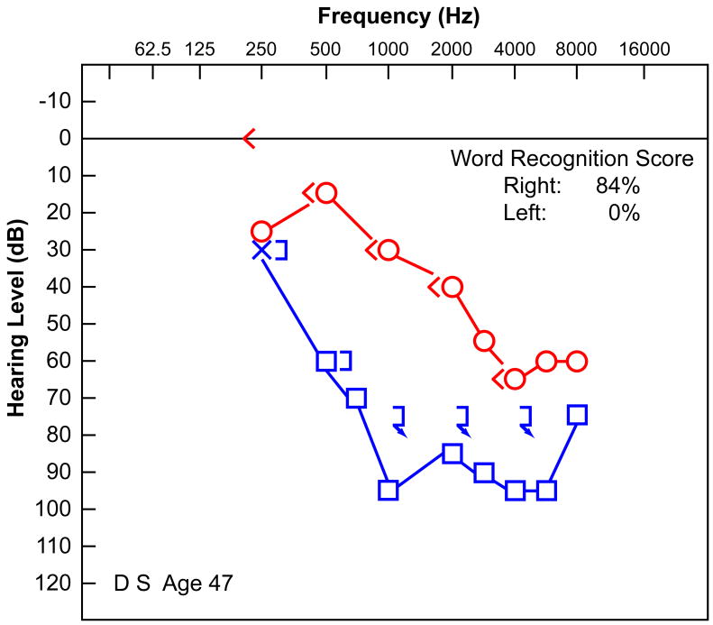 FIG. 1