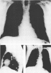 81