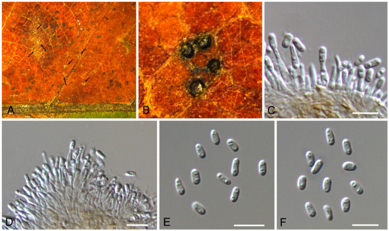 Figure 22