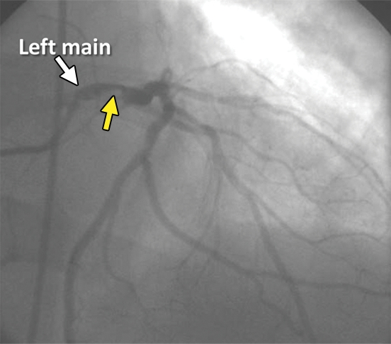 Figure 3b