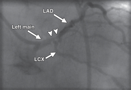 Figure 5c