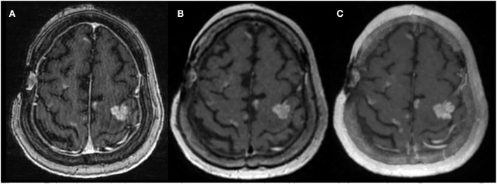 Figure 2