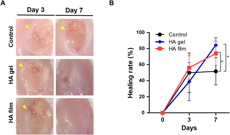 Figure 4
