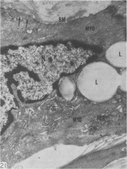 Fig. 21