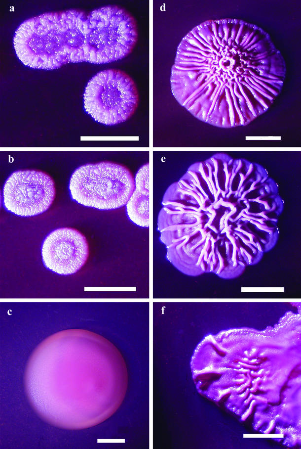 Novel Selective Medium for Isolation of Burkholderia pseudomallei - PMC