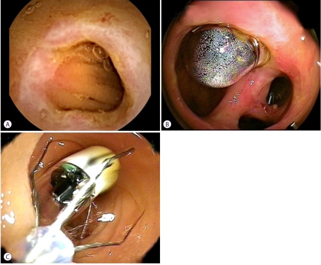 Fig. 2.