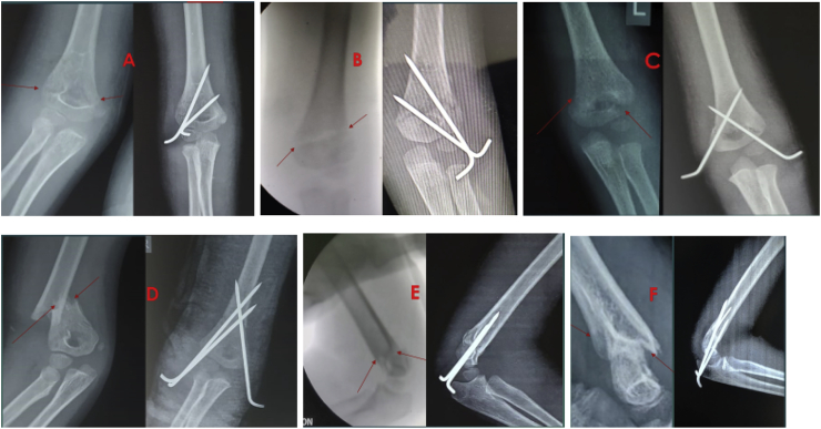 Fig. 1