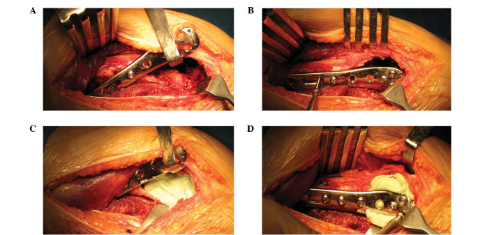 Figure 1.