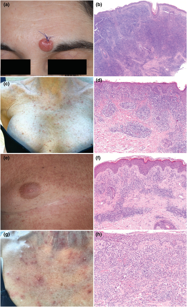 FIGURE 1