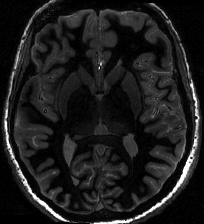 Figure 3 (right):