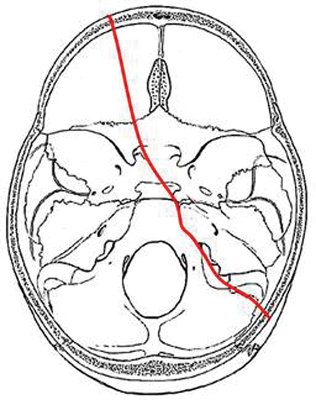 Figure 8