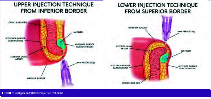 FIGURE 1.