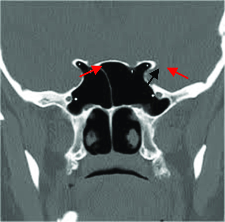 Fig. 5