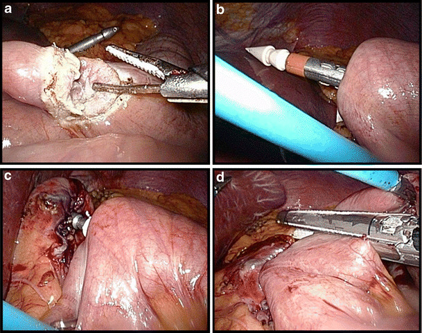 Fig. 4