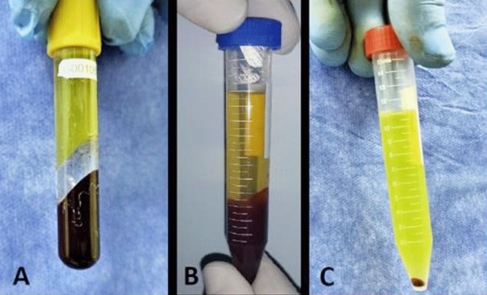 Figure1