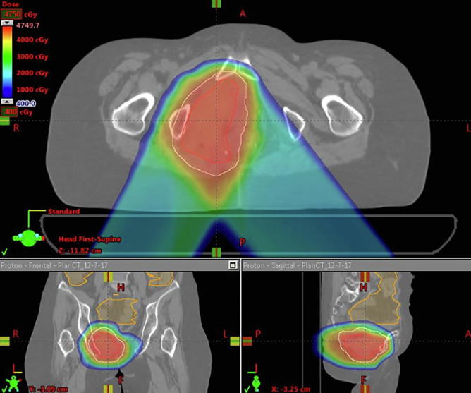 Fig. 1A