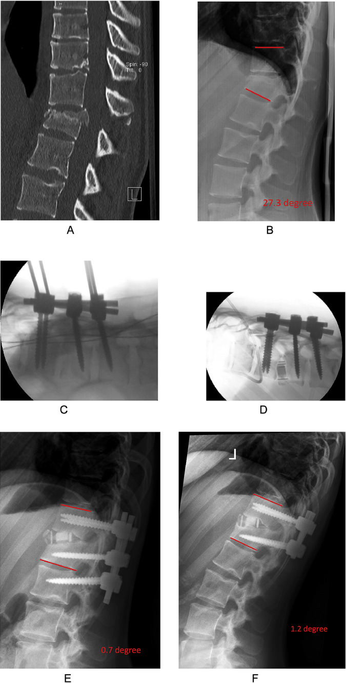 Fig 2