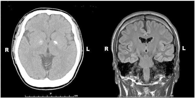 Fig. 1