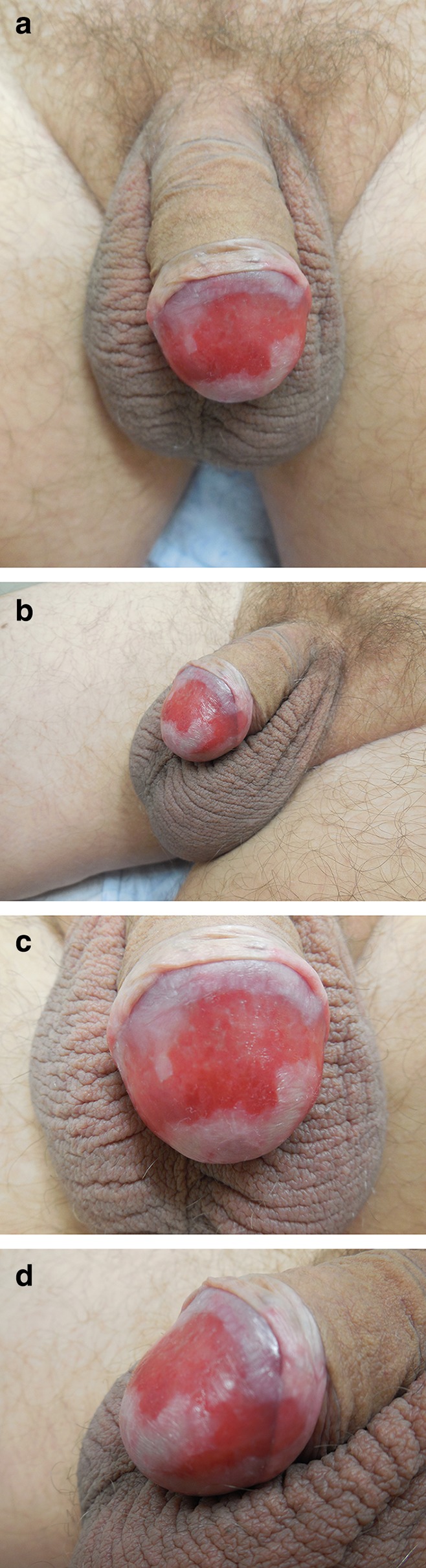 Fig. 1