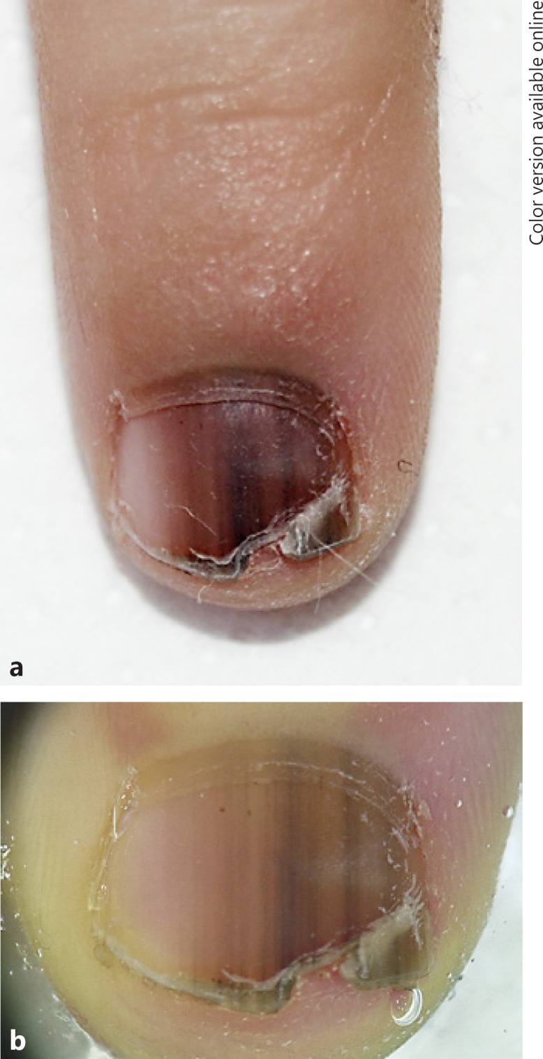 Fig. 16.