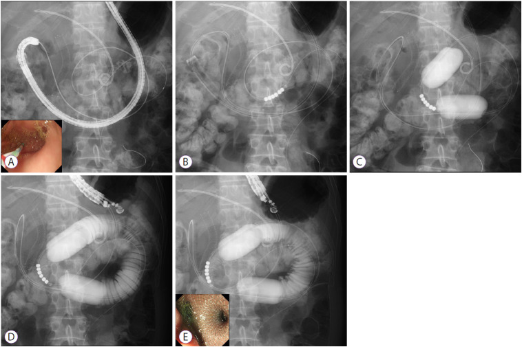 Fig. 2.