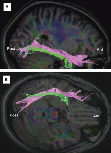 Fig. 10