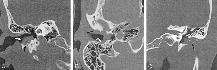 Fig 2.