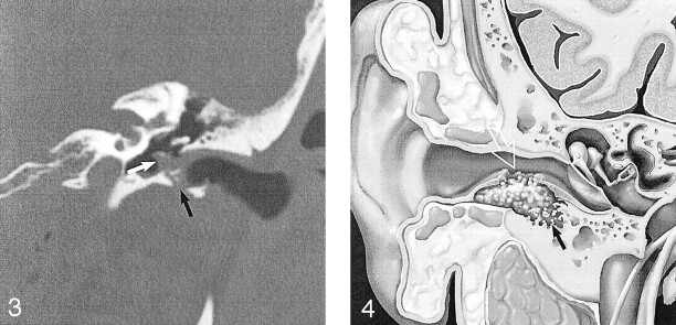 Fig 3.