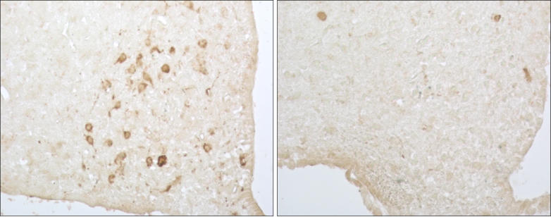 Normal mouse hypothalamic tissue (left) and mutant tissue (right), with Pomc neurons deleted