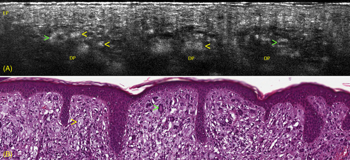 FIGURE 3