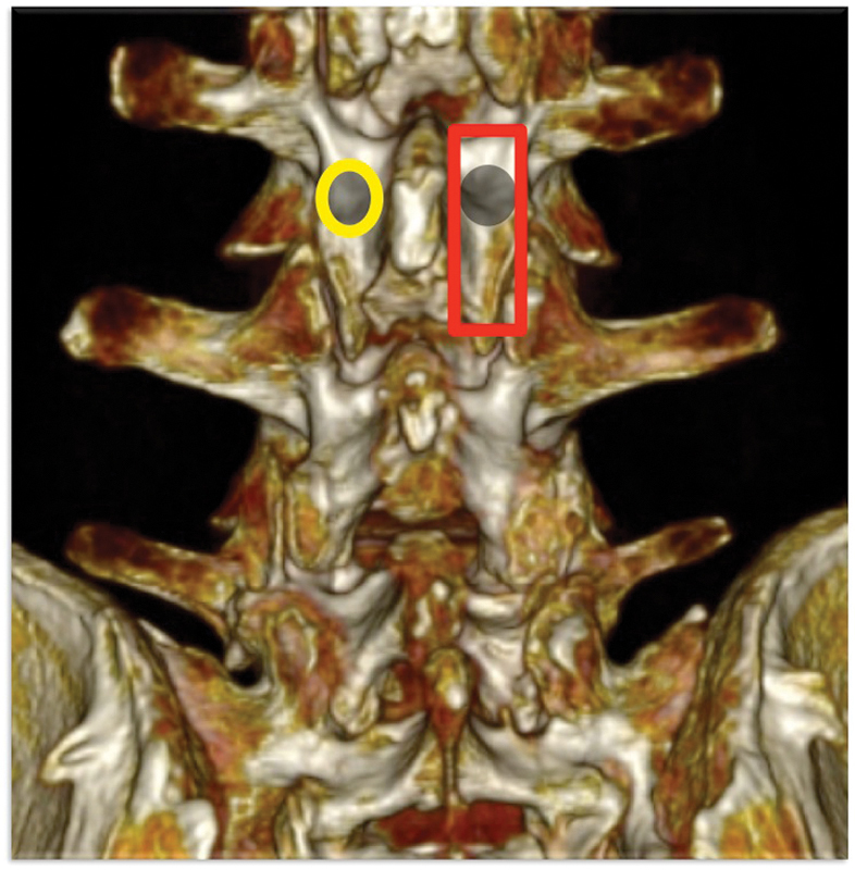 Fig. 15