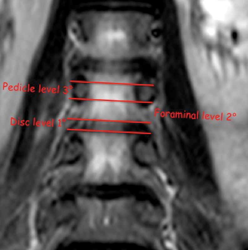 Fig. 16