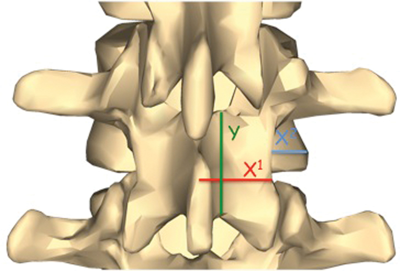 Fig. 13