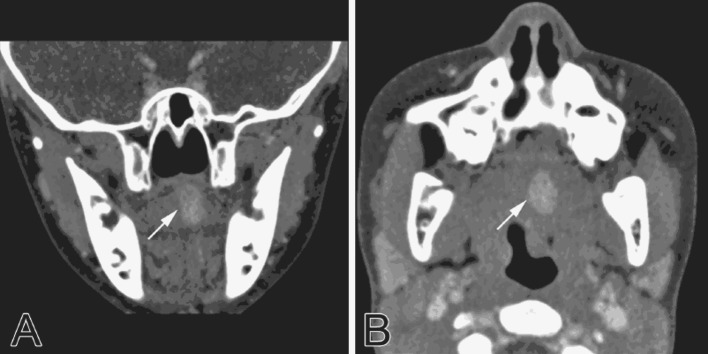 Fig. 1