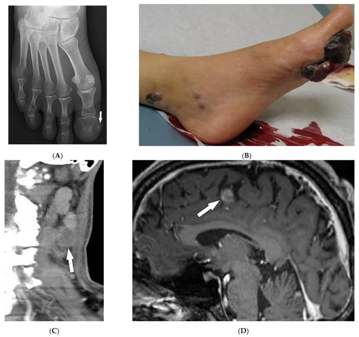 Figure 20