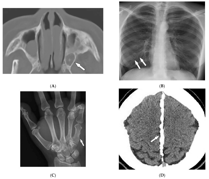 Figure 12