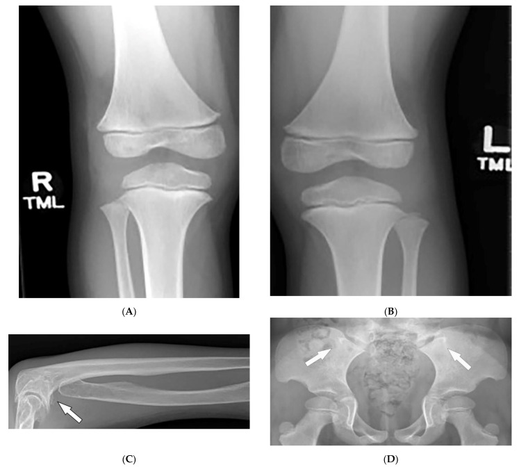 Figure 16