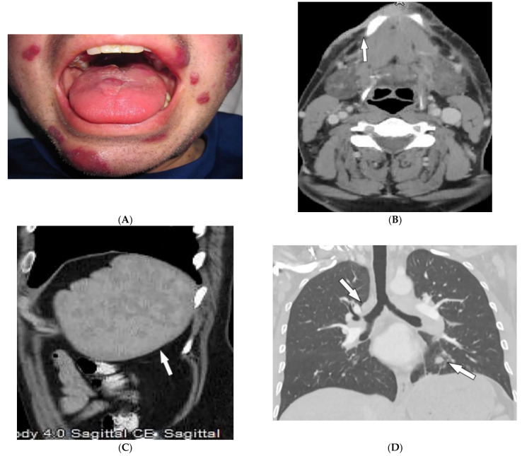 Figure 21