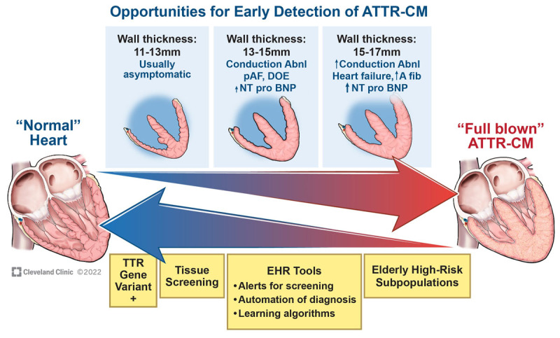 Figure 1 Opportunities for Early Detection of ATTR-CM