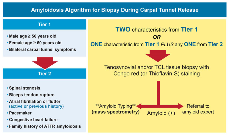 Figure 5 Amyloidosis algorithm for biopsy during carpal tunnel release