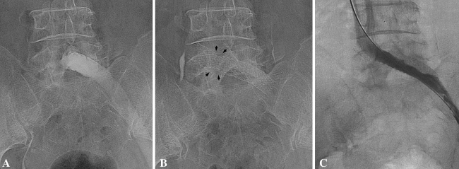 Fig. 1A–C