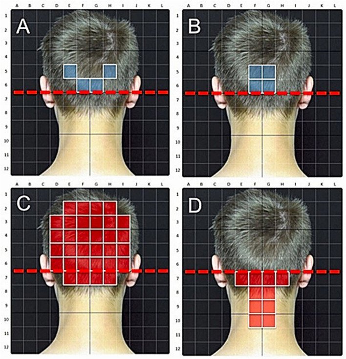 Fig. 3