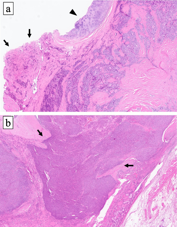 Fig. 5