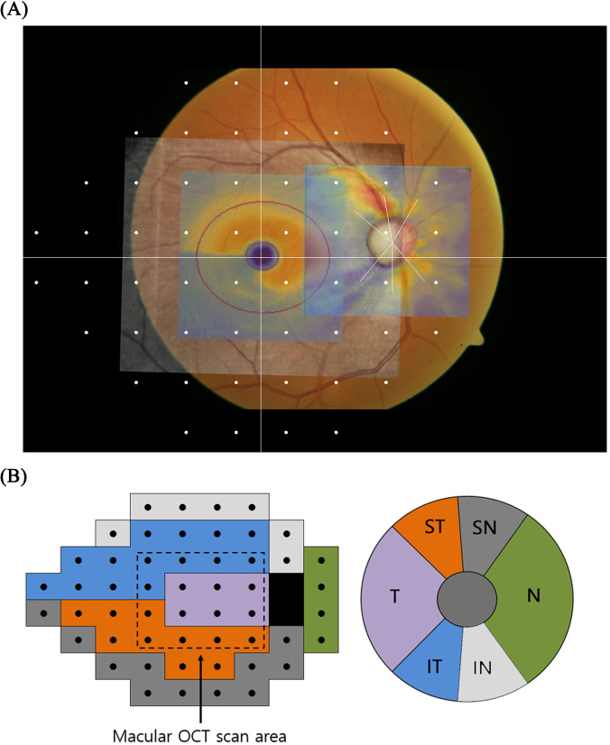 Fig 2