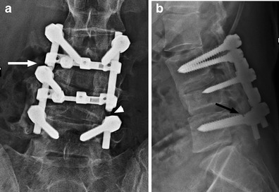 Fig. 26