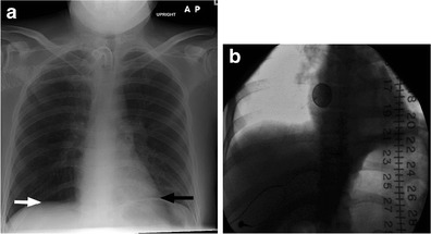 Fig. 11