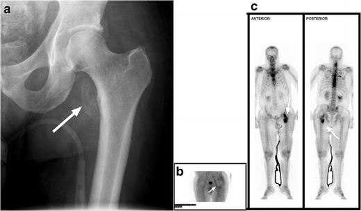 Fig. 19