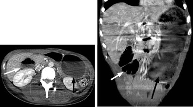 Fig. 10