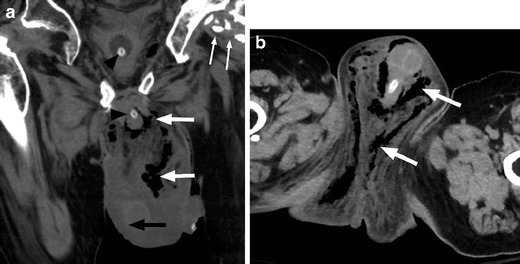 Fig. 22